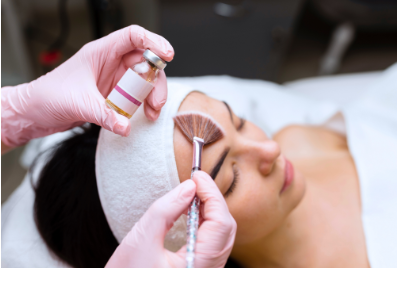 Chemical peel treatment